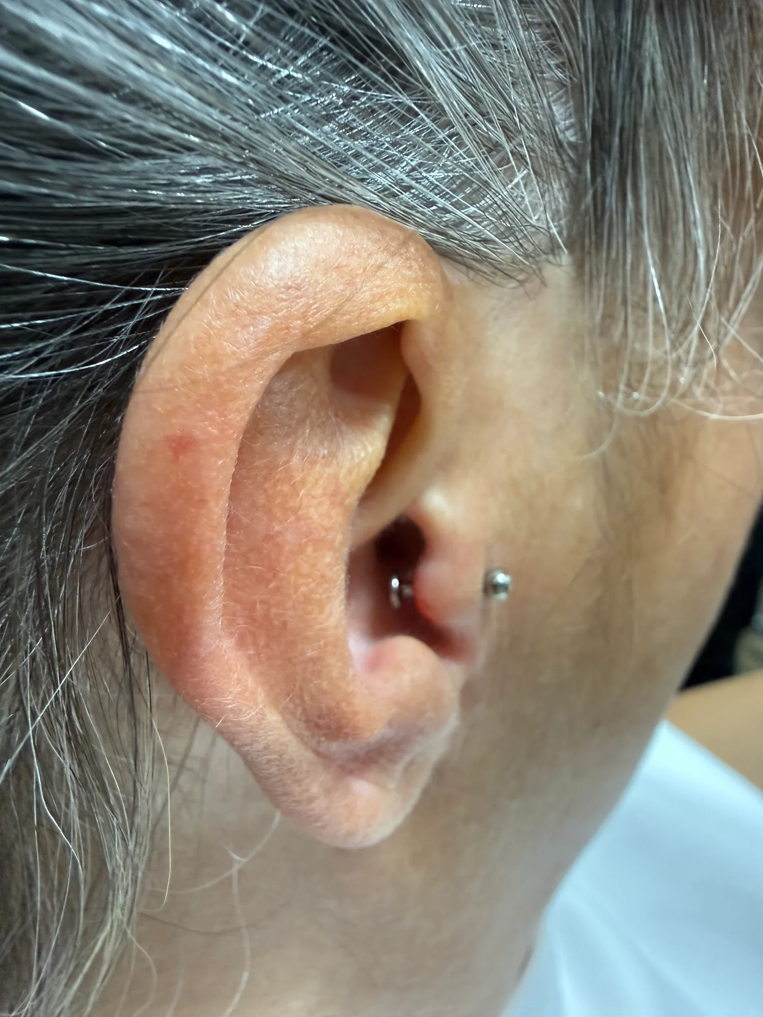 Tragus